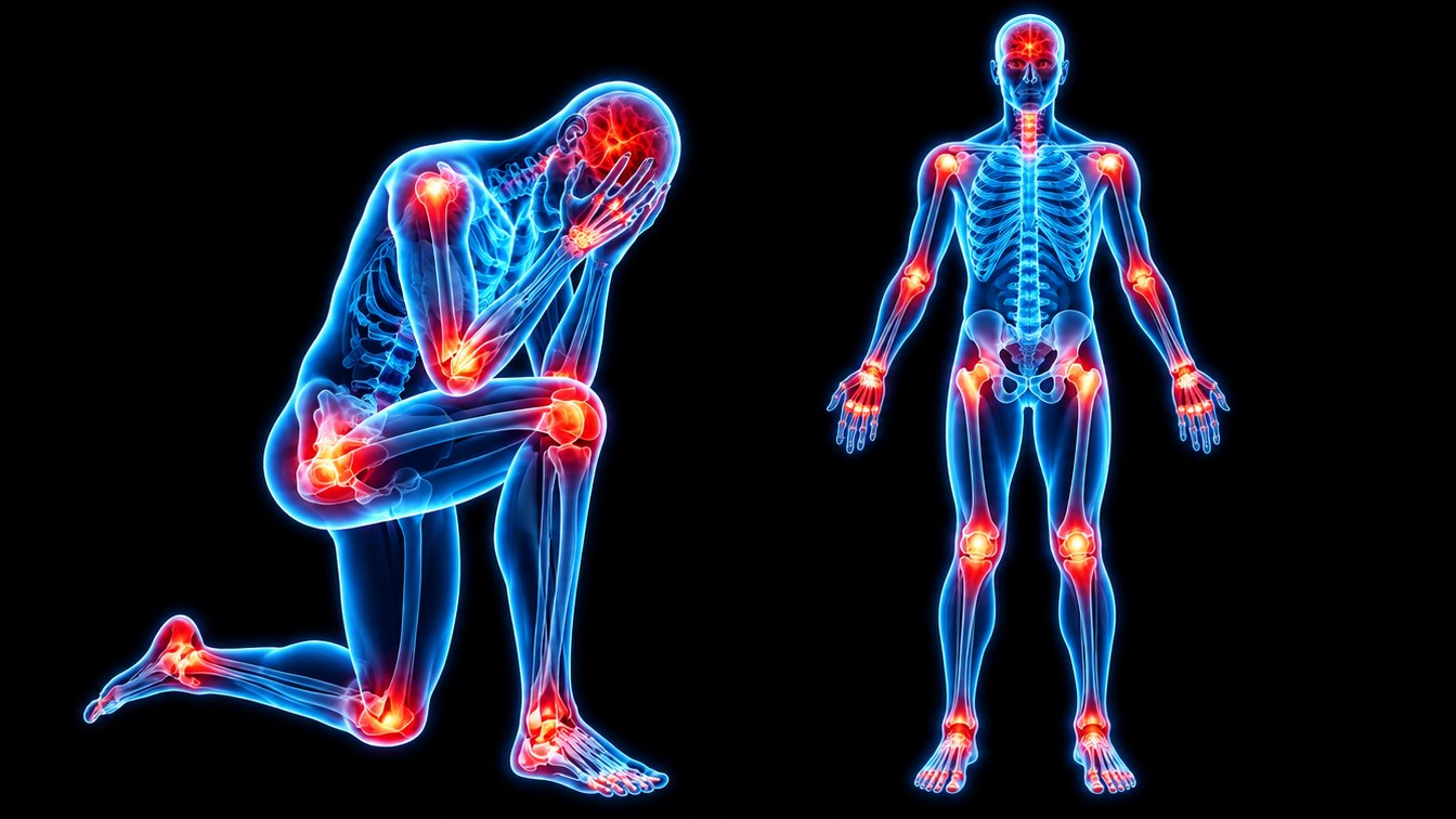 Introduction to Chronic Inflammation video thumbnail